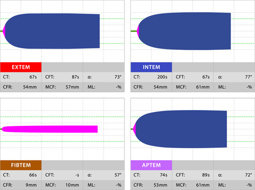 rotem_normaali rotem_normaali