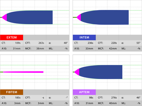 rotem_fibpuute rotem_fibpuute