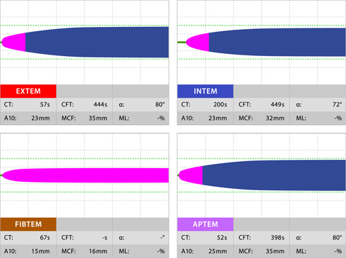 rotem_trombpuute rotem_trombpuute